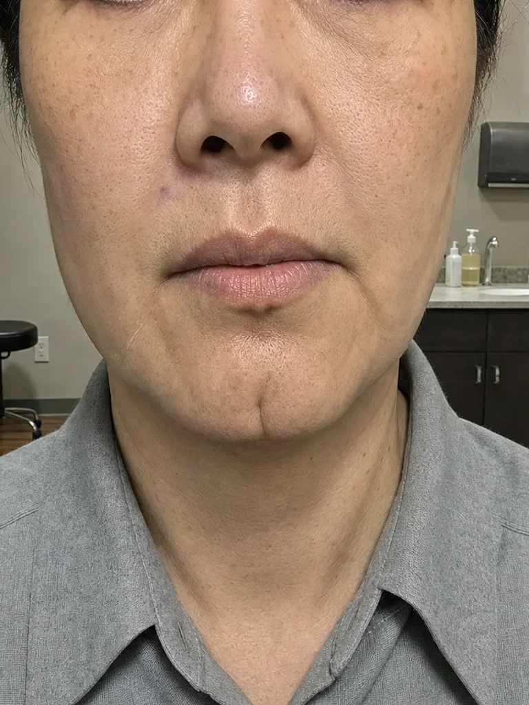 After