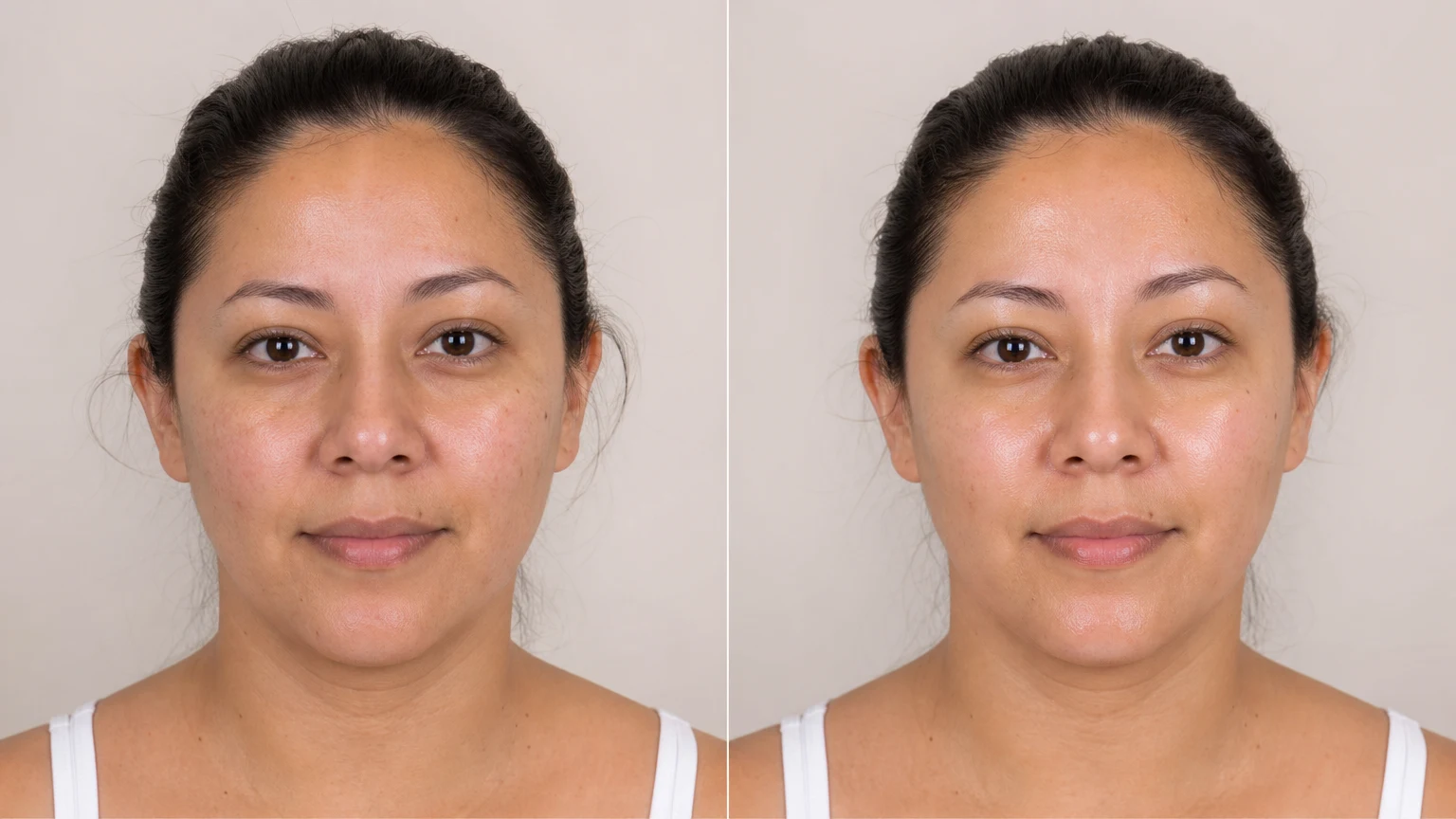 Before-and-after example of hydrated, radiant skin after a HydraFacial.